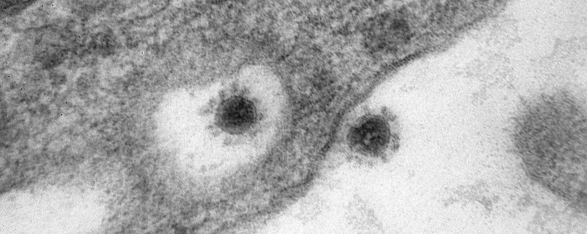 Фото дельта-штамма (индийского варианта) коронавируса, опубликованное научным центром Вектор - Sputnik Латвия, 1920, 28.10.2021
