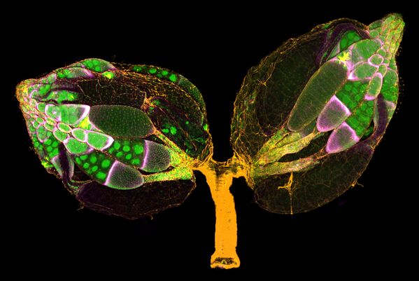 Снимок A pair of ovaries from an adult Drosophila female stained for F-actin (yellow) and nuclei (green); follicle cells are marked by GFP (magenta) американских фотографов Dr. Yujin Chen & Dr. Jocelyn McDonald, занявший 11-е место в фотоконкурсе Nikon Small World - 2019 Снимок A pair of ovaries from an adult Drosophila female stained for F-actin (yellow) and nuclei (green); follicle cells are marked by GFP (magenta) американских фотографов Dr. Yujin Chen & Dr. Jocelyn McDonald, занявший 11-е место в фотоконкурсе Nikon Small World - 2019 - Sputnik Латвия