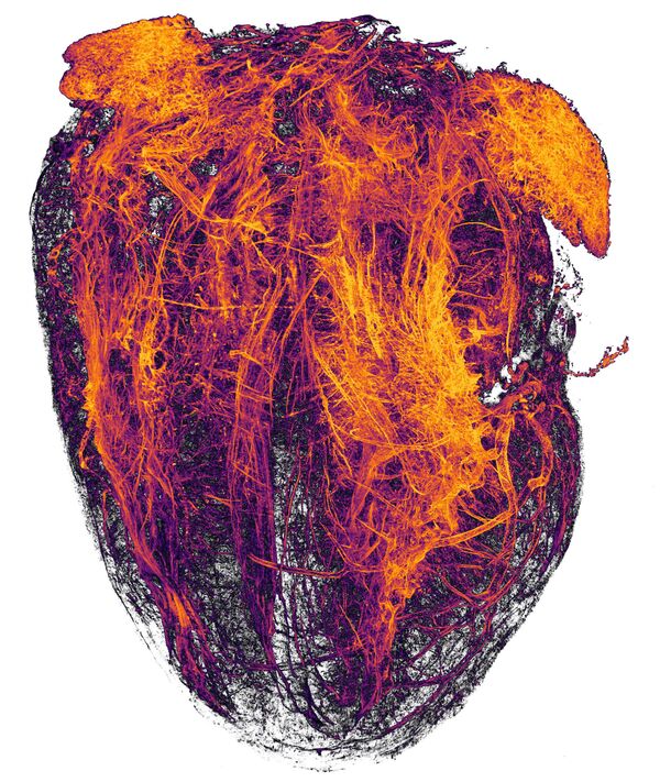 Снимок Blood vessels of a murine (mouse) heart following myocardial infarction (heart attack) фотографов Simon Merz, Lea Bornemann и Sebastian Korste , занявший 20-е место в фотоконкурсе Nikon Small World - 2019 Снимок Blood vessels of a murine (mouse) heart following myocardial infarction (heart attack) фотографов Simon Merz, Lea Bornemann и Sebastian Korste , занявший 20-е место в фотоконкурсе Nikon Small World - 2019 - Sputnik Латвия