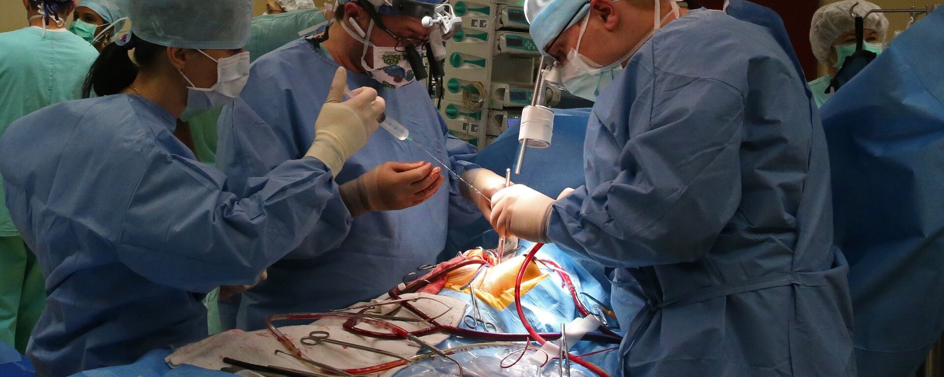 Хирурги проводят операцию на открытом сердце - Sputnik Latvija, 1920, 28.02.2018